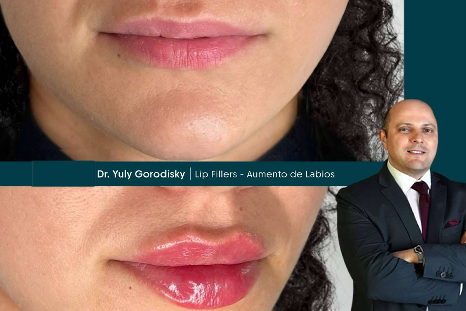 From Hollywood to Miami; Elite Plastic Surgery Is Now Closer Than Ever